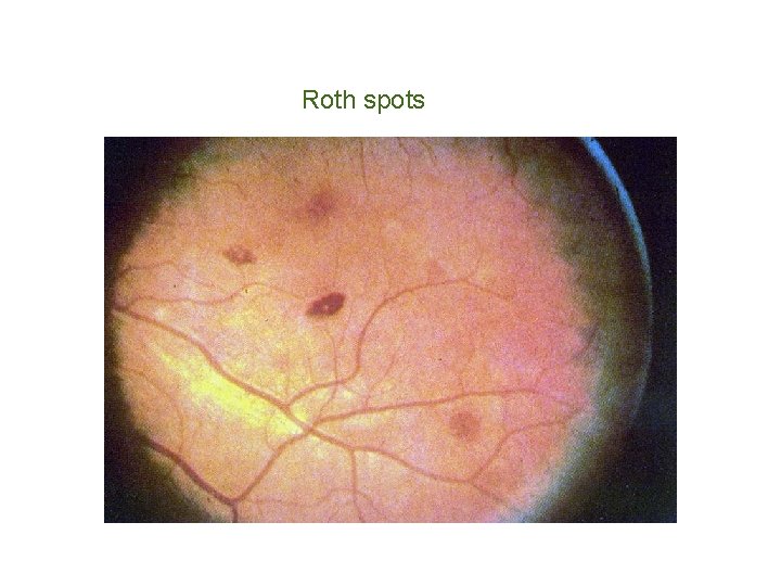 Roth spots 