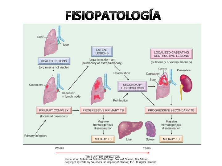 FISIOPATOLOGÍA 