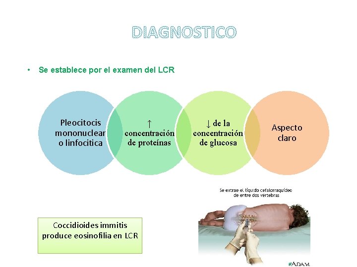  • Se establece por el examen del LCR Pleocitocis mononuclear o linfocitica ↑