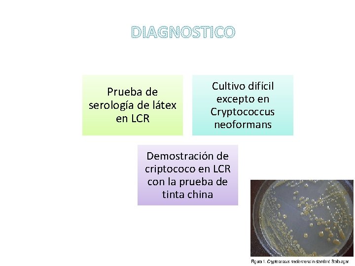 Prueba de serología de látex en LCR Cultivo difícil excepto en Cryptococcus neoformans Demostración