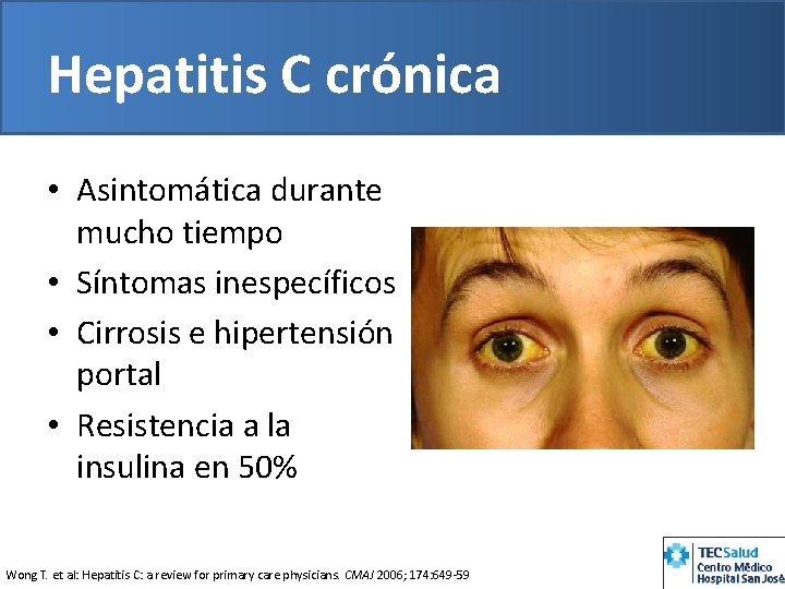 Hepatitis C crónica • Asintomática durante mucho tiempo • Síntomas inespecíficos • Cirrosis e