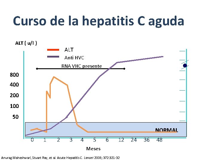 Curso de la hepatitis C aguda ALT ( u/l ) ALT Anti HVC RNA