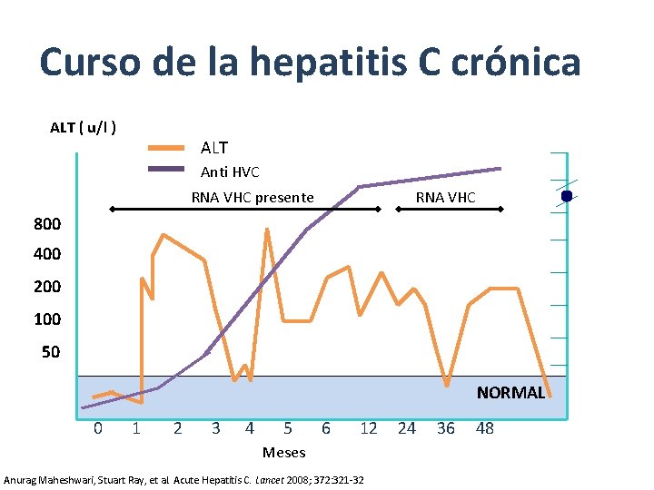 Curso de la hepatitis C crónica ALT ( u/l ) ALT Anti HVC RNA