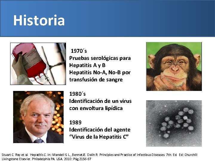 Historia 1970´s Pruebas serológicas para Hepatitis A y B Hepatitis No-A, No-B por transfusión