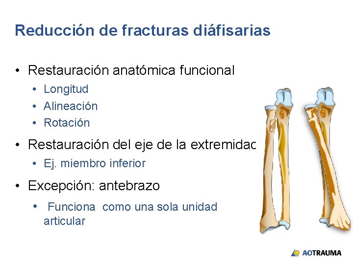 Reducción de fracturas diáfisarias • Restauración anatómica funcional • Longitud • Alineación • Rotación