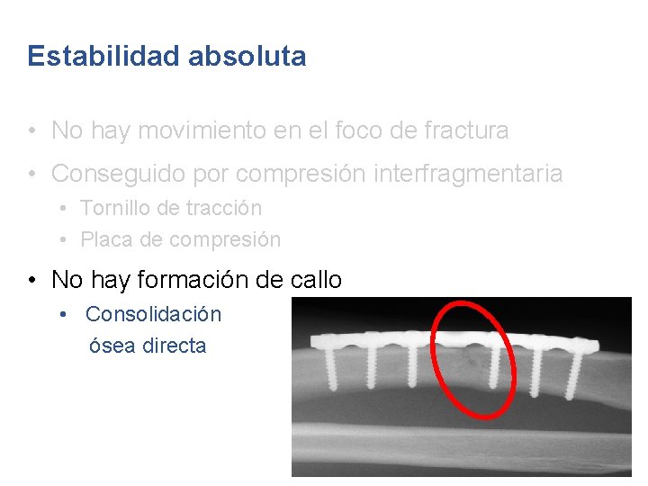 Estabilidad absoluta • No hay movimiento en el foco de fractura • Conseguido por