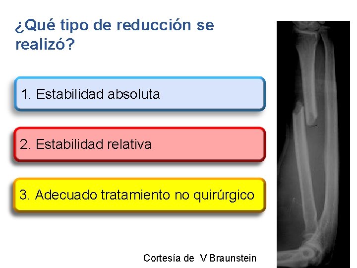 ¿Qué tipo de reducción se realizó? 1. Estabilidad absoluta 2. Estabilidad relativa 3. Adecuado