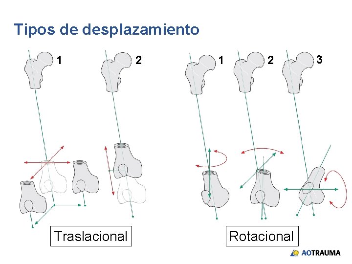 Tipos de desplazamiento 1 Traslacional 2 1 2 Rotacional 3 