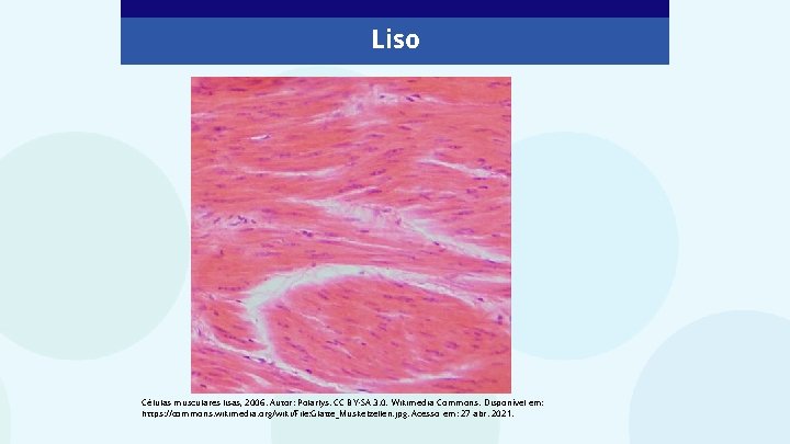 Liso Células musculares lisas, 2006. Autor: Polarlys. CC BY-SA 3. 0. Wikimedia Commons. Disponível