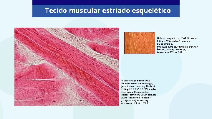 Tecido muscular estriado esquelético Músculo esquelético, 2006. Domínio Público. Wikimedia Commons. Disponível em: https: