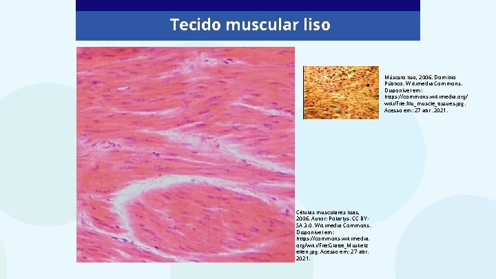 Tecido muscular liso Músculo liso, 2006. Domínio Público. Wikimedia Commons. Disponível em: https: //commons.