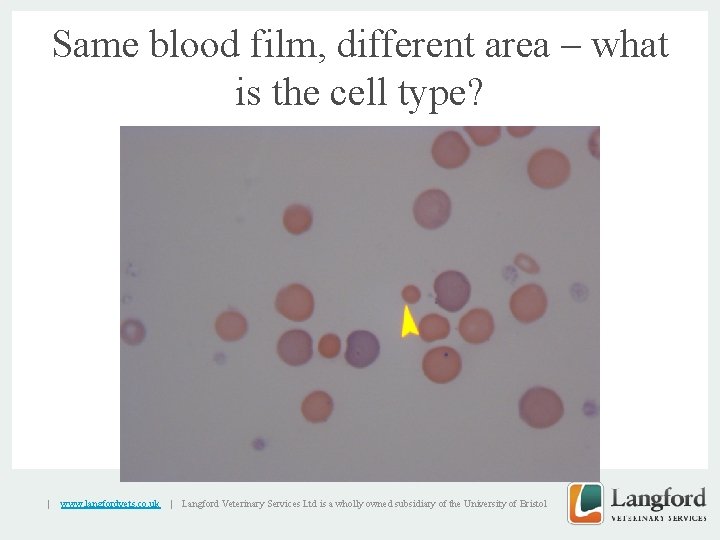 Same blood film, different area – what is the cell type? v | www.