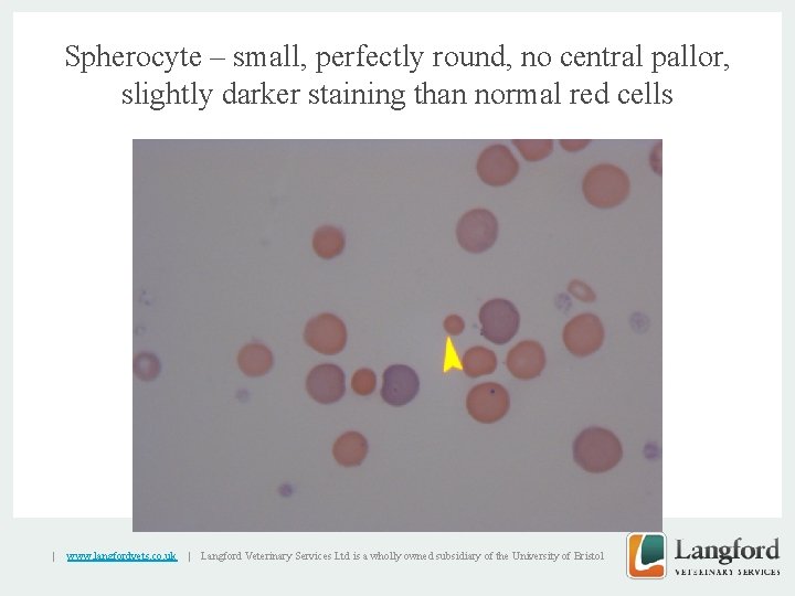 Spherocyte – small, perfectly round, no central pallor, slightly darker staining than normal red