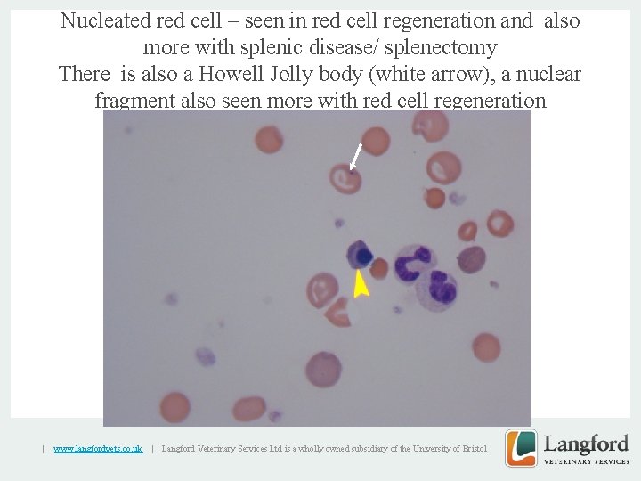Nucleated red cell – seen in red cell regeneration and also more with splenic