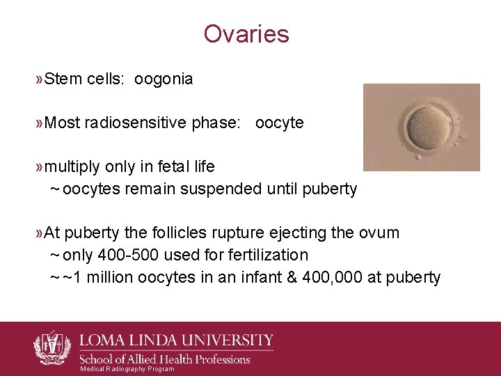 Ovaries » Stem cells: oogonia » Most radiosensitive phase: oocyte » multiply only in Ovaries » Stem cells: oogonia » Most radiosensitive phase: oocyte » multiply only in