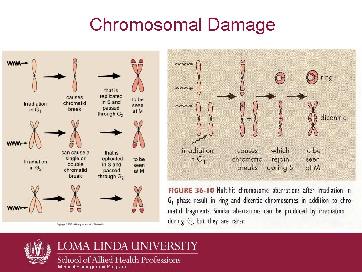 Chromosomal Damage Medical Radiography Program Chromosomal Damage Medical Radiography Program