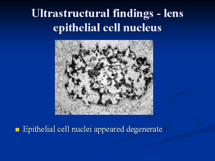 Ultrastructural findings - lens epithelial cell nucleus n Epithelial cell nuclei appeared degenerate 