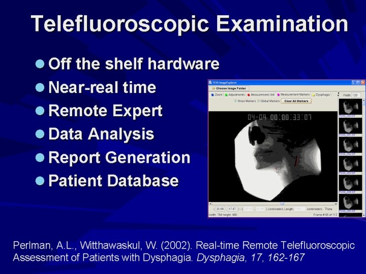 Telefluoroscopic Examination Off the shelf hardware Near-real time Remote Expert Data Analysis Report Generation