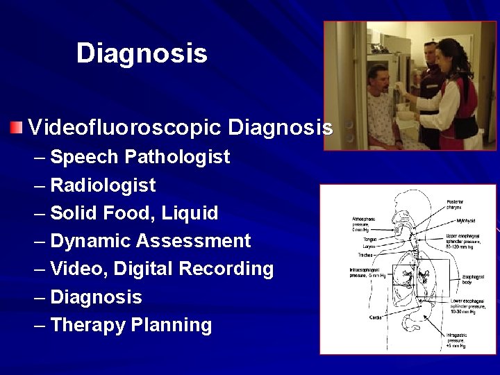 Diagnosis Videofluoroscopic Diagnosis – Speech Pathologist – Radiologist – Solid Food, Liquid – Dynamic