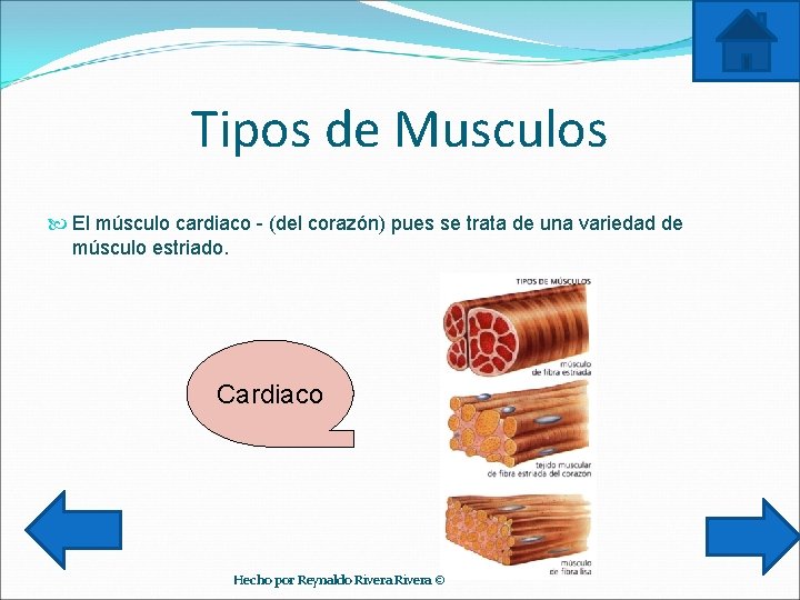 Tipos de Musculos El músculo cardiaco - (del corazón) pues se trata de una