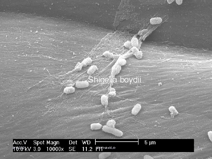 Shigella boydii 9/18/2021 alen vukelić, dr 7 