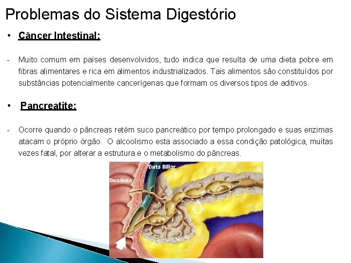 Problemas do Sistema Digestório • Câncer Intestinal: - Muito comum em países desenvolvidos, tudo