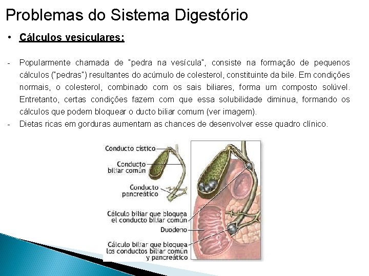 Problemas do Sistema Digestório • Cálculos vesiculares: - - Popularmente chamada de “pedra na