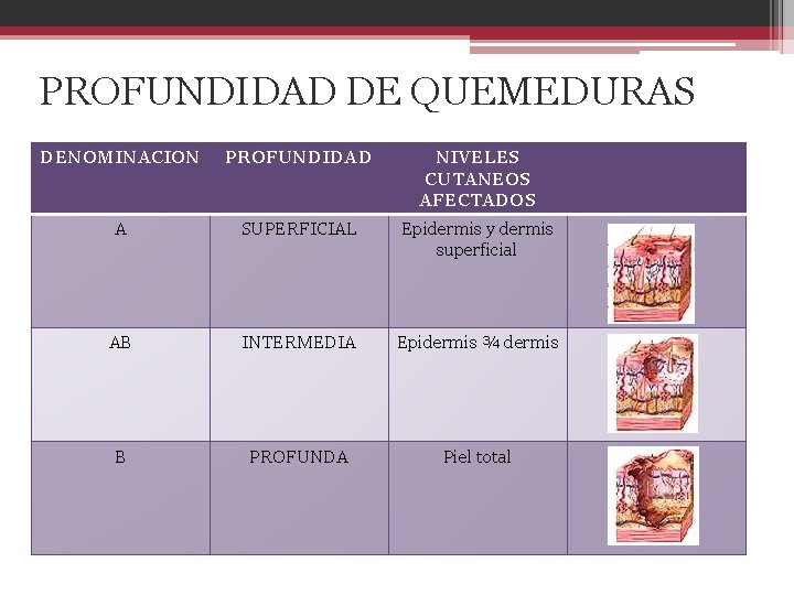 PROFUNDIDAD DE QUEMEDURAS DENOMINACION PROFUNDIDAD NIVELES CUTANEOS AFECTADOS A SUPERFICIAL Epidermis y dermis superficial