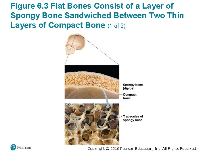 Figure 6. 3 Flat Bones Consist of a Layer of Spongy Bone Sandwiched Between