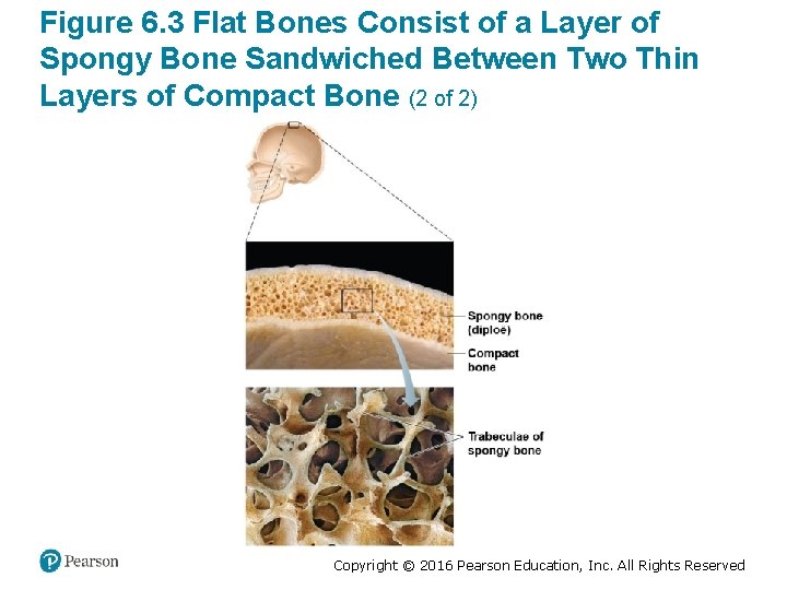 Figure 6. 3 Flat Bones Consist of a Layer of Spongy Bone Sandwiched Between