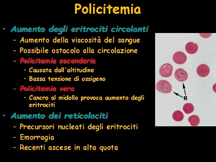 Policitemia • Aumento degli eritrociti circolanti – Aumento della viscosità del sangue – Possibile