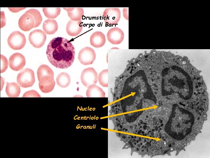 Drumstick o Corpo di Barr Nucleo Centriolo Granuli 