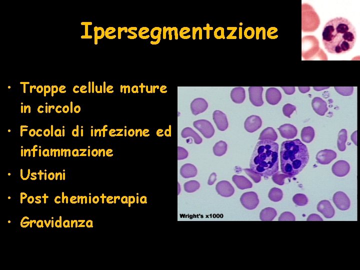 Ipersegmentazione • Troppe cellule mature in circolo • Focolai di infezione ed infiammazione •