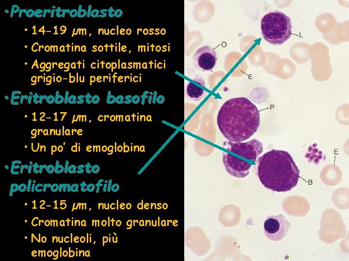  • Proeritroblasto • 14 -19 µm, nucleo rosso • Cromatina sottile, mitosi •