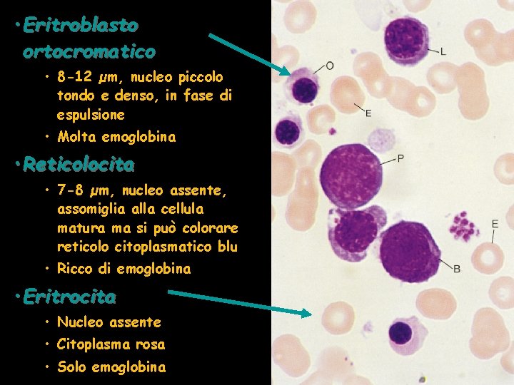  • Eritroblasto ortocromatico • 8 -12 µm, nucleo piccolo tondo e denso, in