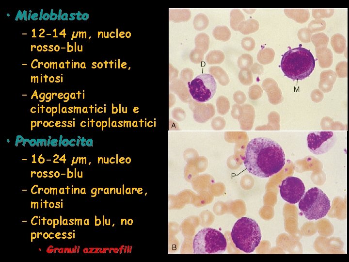  • Mieloblasto – 12 -14 µm, nucleo rosso-blu – Cromatina sottile, mitosi –
