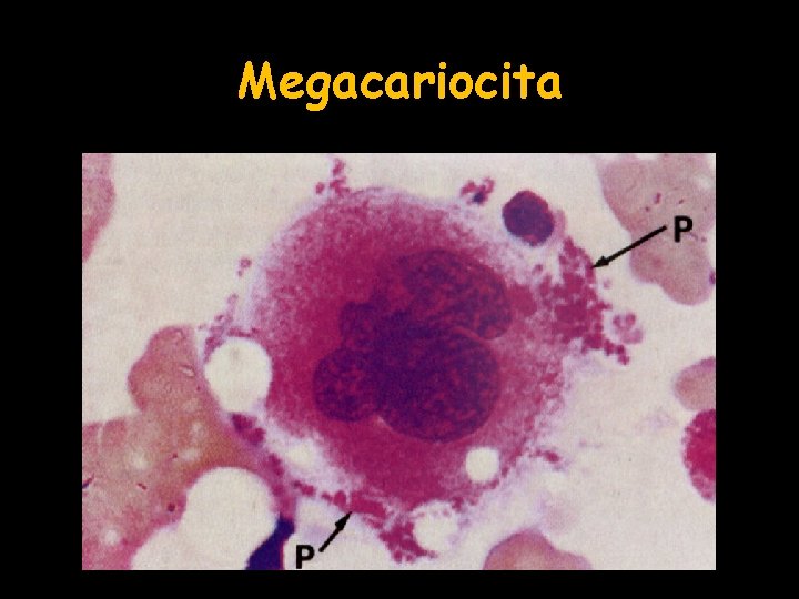 Megacariocita 