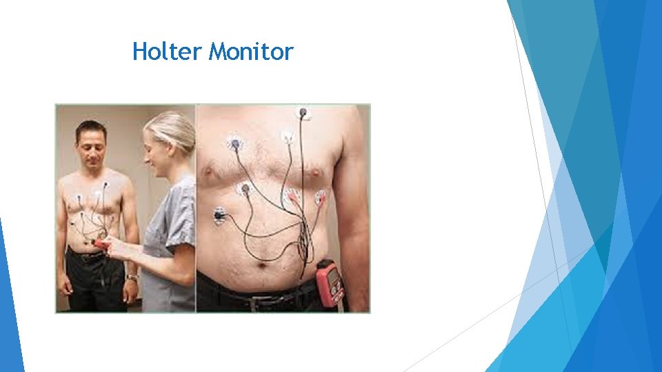Holter Monitor 