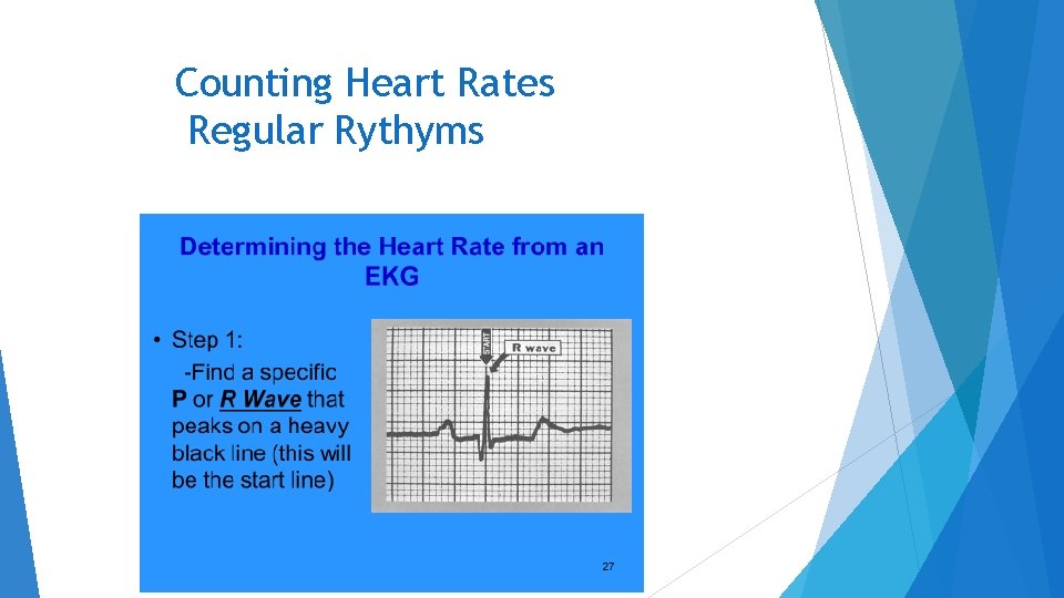 Counting Heart Rates Regular Rythyms 