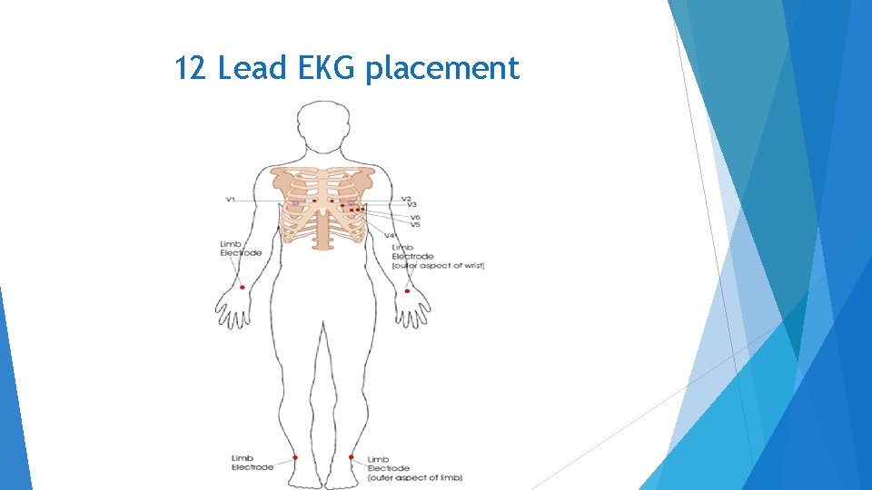 12 Lead EKG placement 
