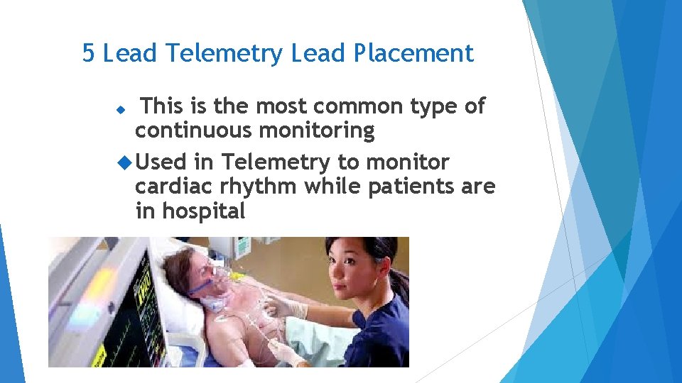 5 Lead Telemetry Lead Placement This is the most common type of continuous monitoring