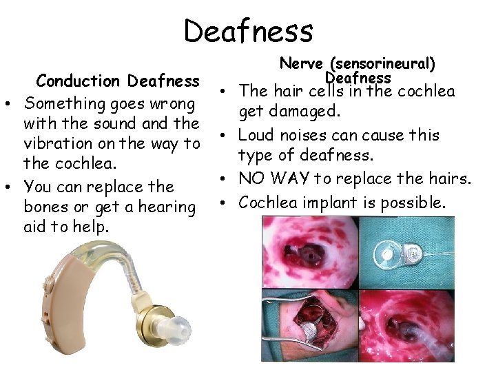 Deafness Conduction Deafness • Something goes wrong with the sound and the vibration on