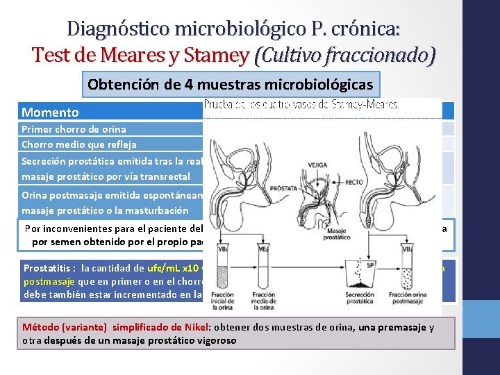 Diagnóstico microbiológico P. crónica: Test de Meares y Stamey (Cultivo fraccionado) Obtención de 4