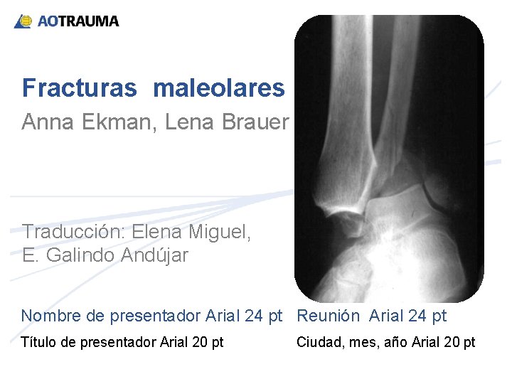 Fracturas maleolares Anna Ekman, Lena Brauer Traducción: Elena Miguel, E. Galindo Andújar Nombre de