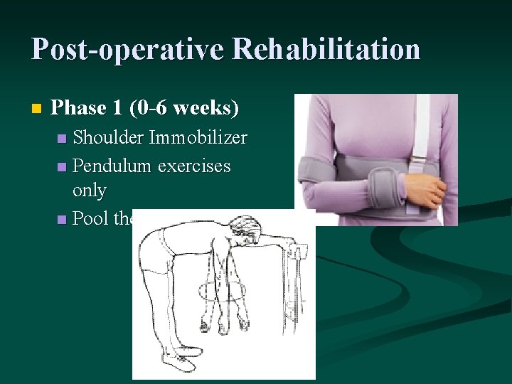 Post-operative Rehabilitation n Phase 1 (0 -6 weeks) Shoulder Immobilizer n Pendulum exercises only