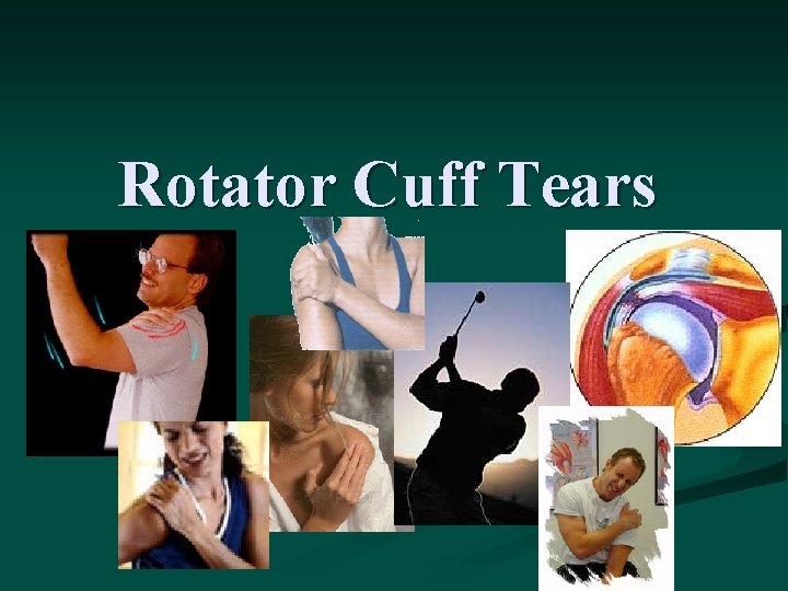 Rotator Cuff Tears 