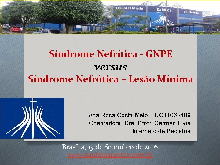 Síndrome Nefrítica - GNPE versus Síndrome Nefrótica – Lesão Mínima Ana Rosa Costa Melo