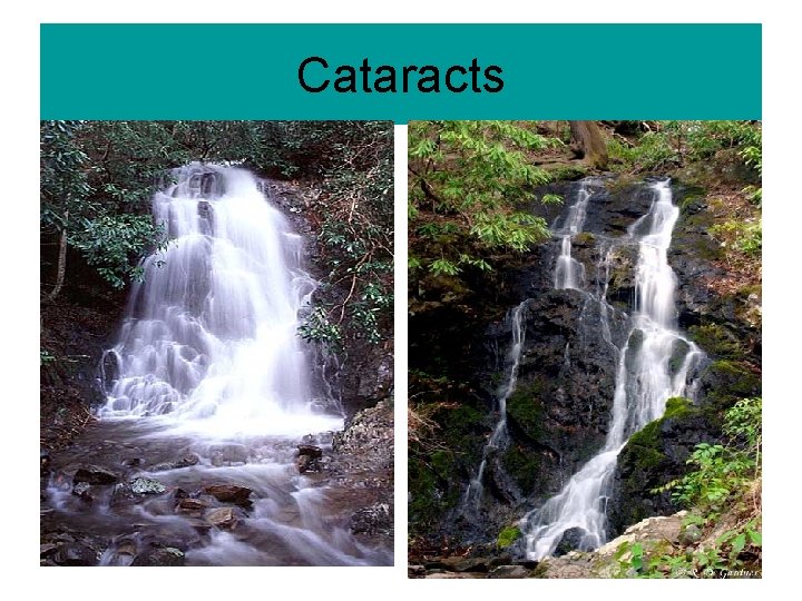 Cataracts 