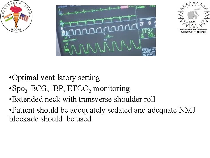  • Optimal ventilatory setting • Spo 2, ECG, BP, ETCO 2 monitoring •