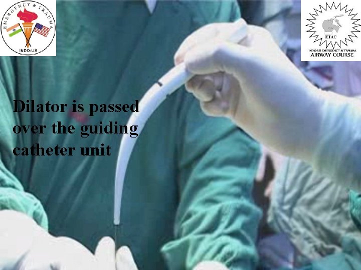 Dilator is passed over the guiding catheter unit 